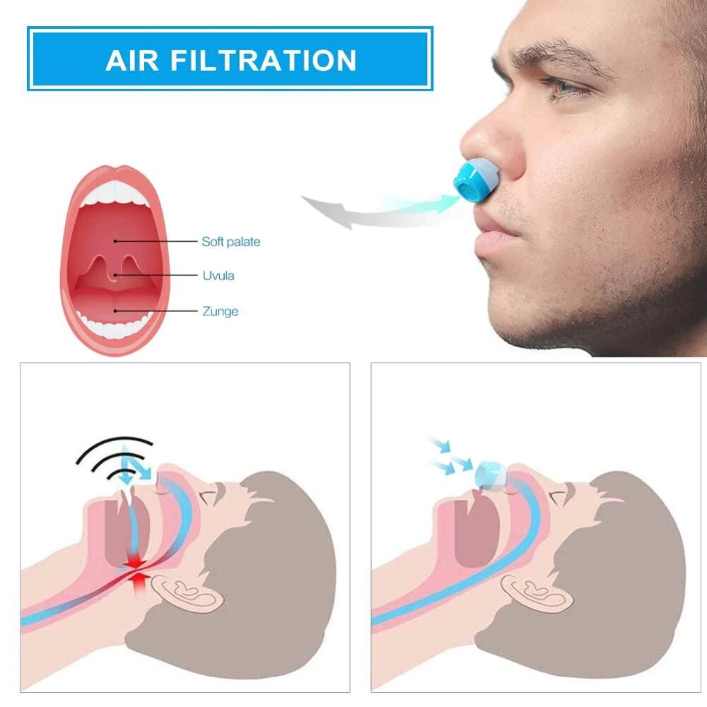 Anti-snorkingsenhet | Slange-, maske- Mikro-CPAP