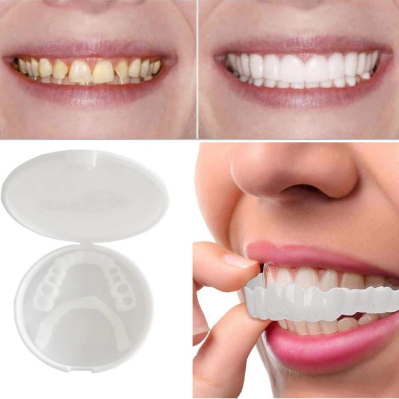 PerfectSnap | Alltid det perfekte smilet