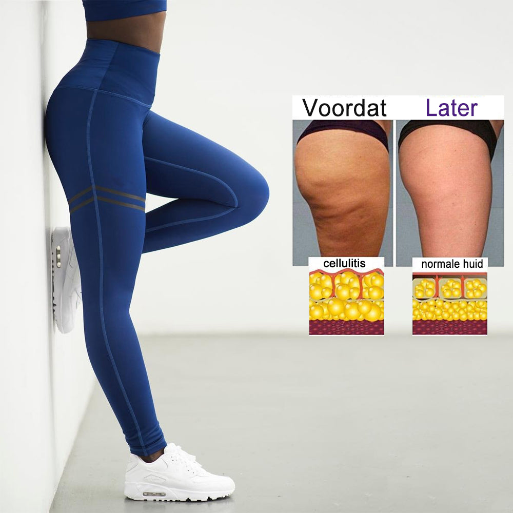 Norvo | Cellulite Kompresjons Leggings for Kvinner