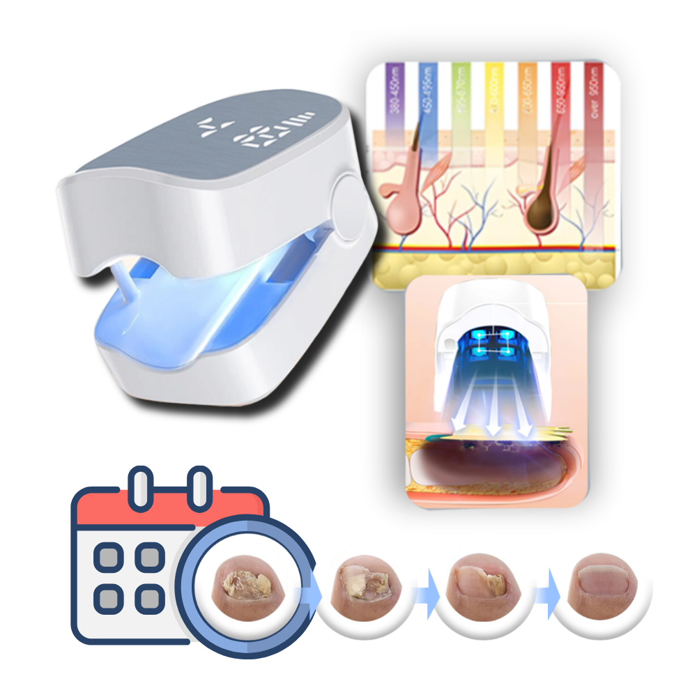 Smertefri Neglesopp-Laser