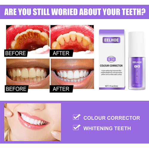 Skanto | Dental Color Corrector