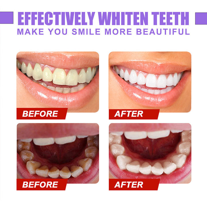 Skanto | Dental Color Corrector