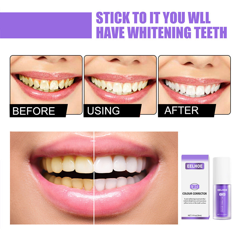 Skanto | Dental Color Corrector