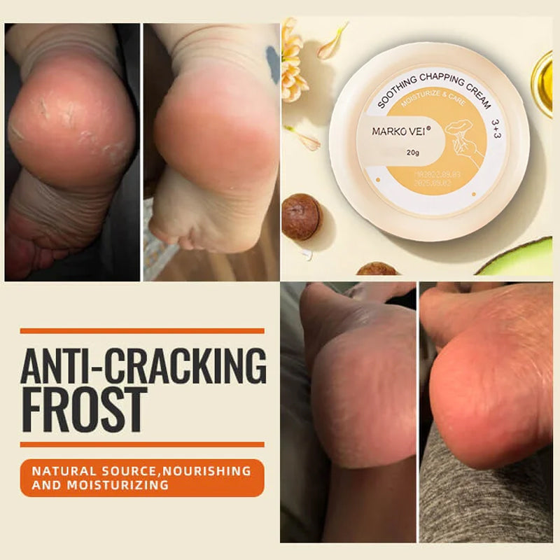 Winter Anti-Rip Frost | Skanto