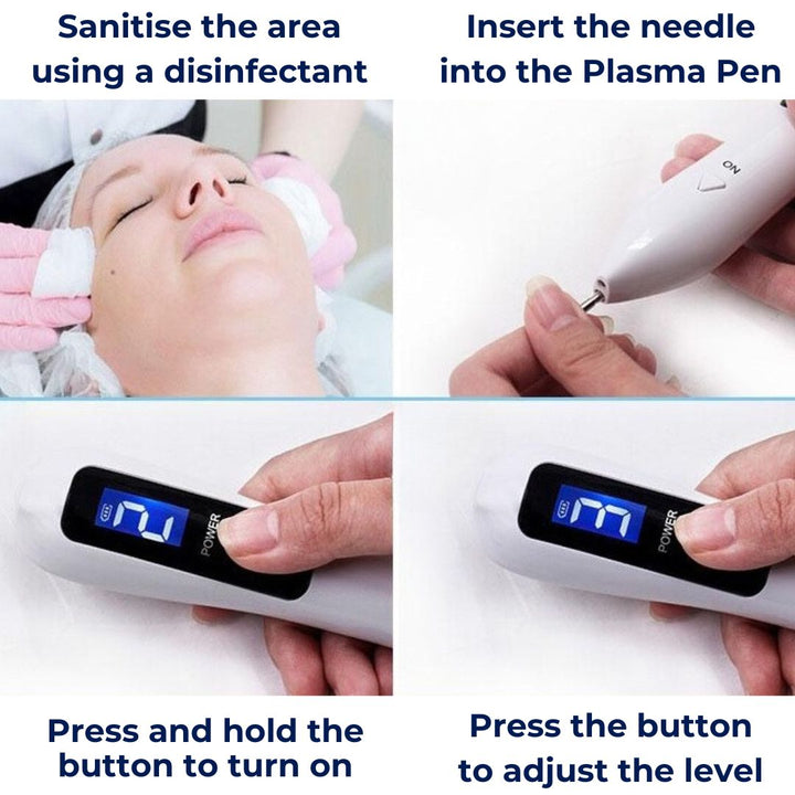 DermaGlow | Mole Removal Pen – Ikke-invasiv plasma – Trådløs & oppladbar – Hjemmebehandling for hudflikker & fregner Skanto