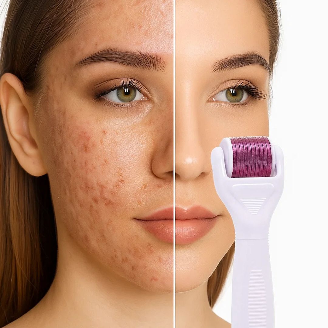 DermaGlow Microneedling Derma Roller Kit – Anti-Aging – Titannåler – Hjemmeskincare for Kvinner Skanto