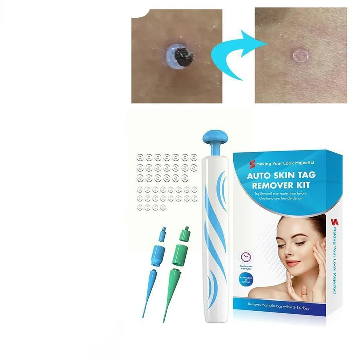 Skanto | DermaClear hudvortefjerner | Smertfri bruk | Kompakt & Hygienisk | For menn & kvinner