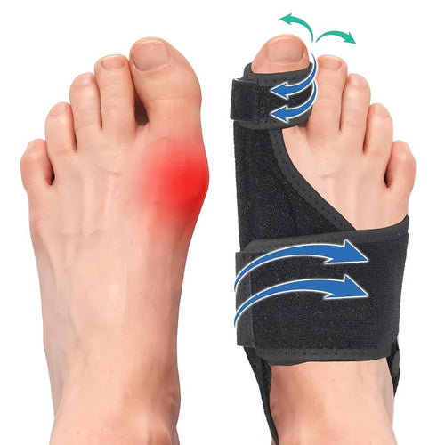 Skanto | Justerbar hallux valgus korrektor