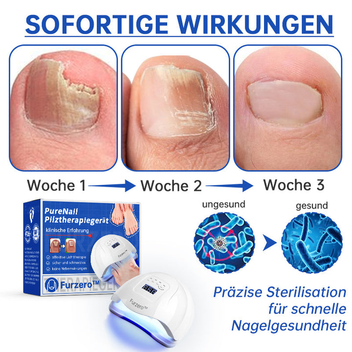 Skanto | PureNail™ | Neglesopp Laserbehandling Enhet - Ditt hemmelige våpen mot neglesopp