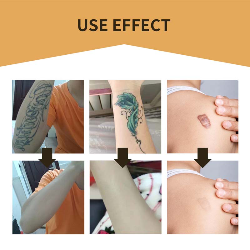 Skanto | Skin Usynlig Concealer Patch