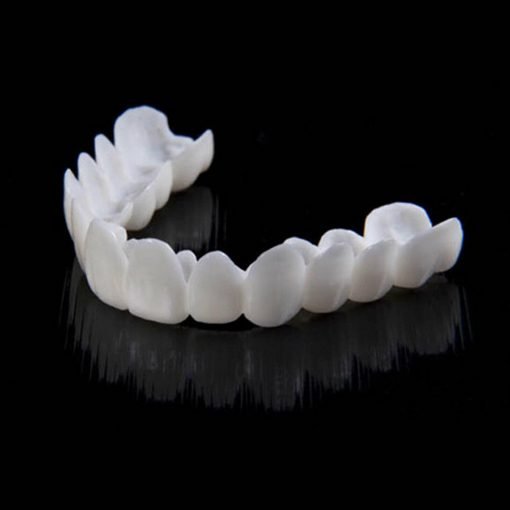 Sofortige Verschönerung Ihres Lächelns med Snap-on-Veneers