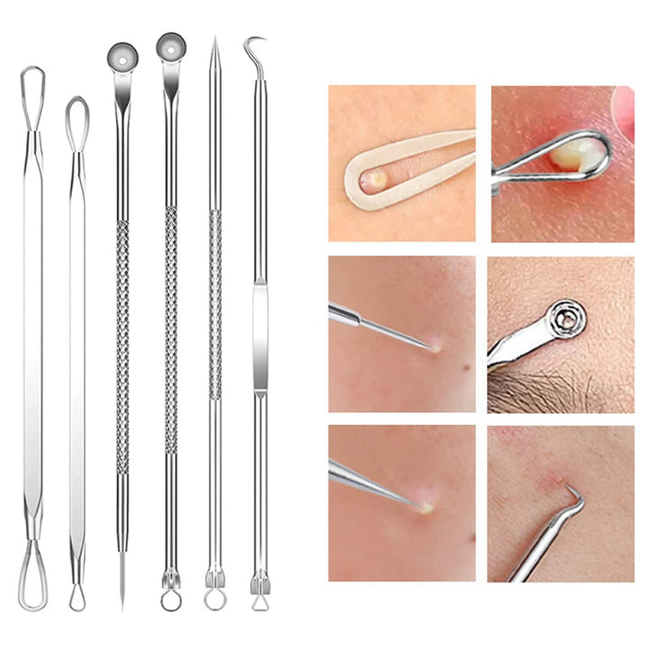 Skanto | Rustfritt stål blackhead remover pimple popper verktøysett med metallboks