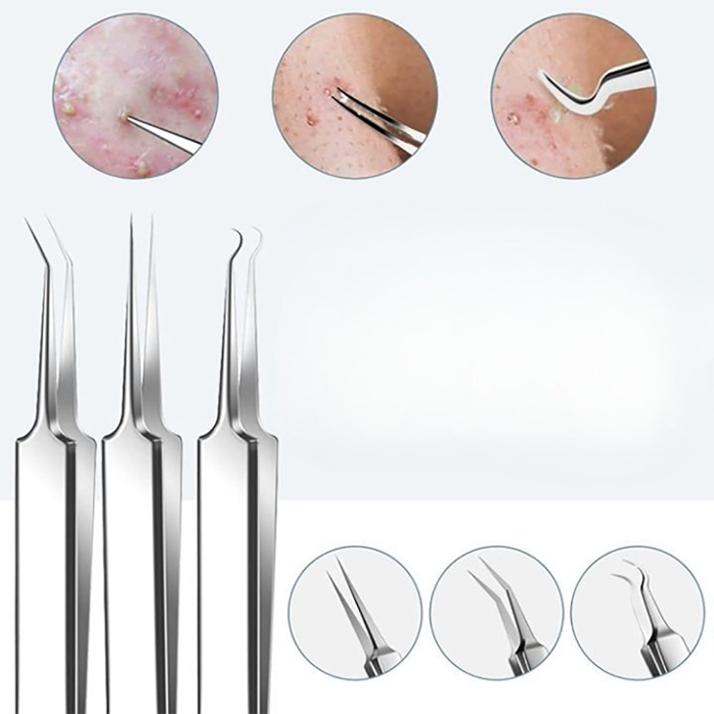 Skanto | Rustfritt stål blackhead remover pimple popper verktøysett med metallboks