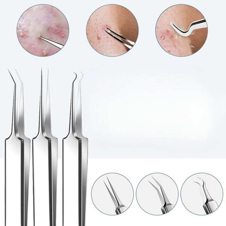 Skanto | Rustfritt stål blackhead remover pimple popper verktøysett med metallboks