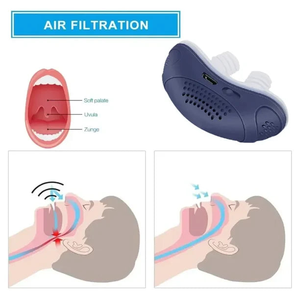 Skanto | Søvnløs, maskefri, Micro-CPAP Anti-Snorking