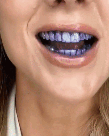 Skanto | Dental Color Corrector