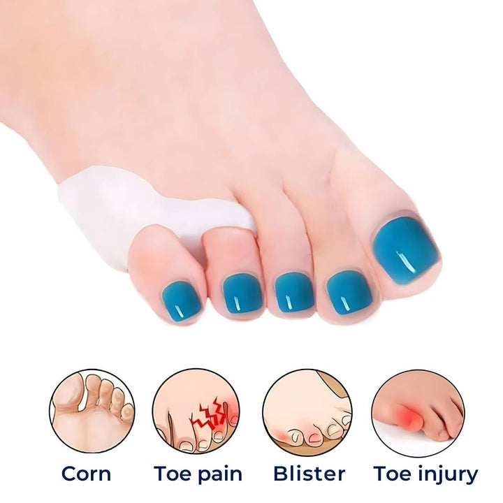 ToeGuard ortopediske tåspacer | Bunionette korrigerer - Lite tå rettet - for hallux valgus - Hammertoe og tåjustering Skanto