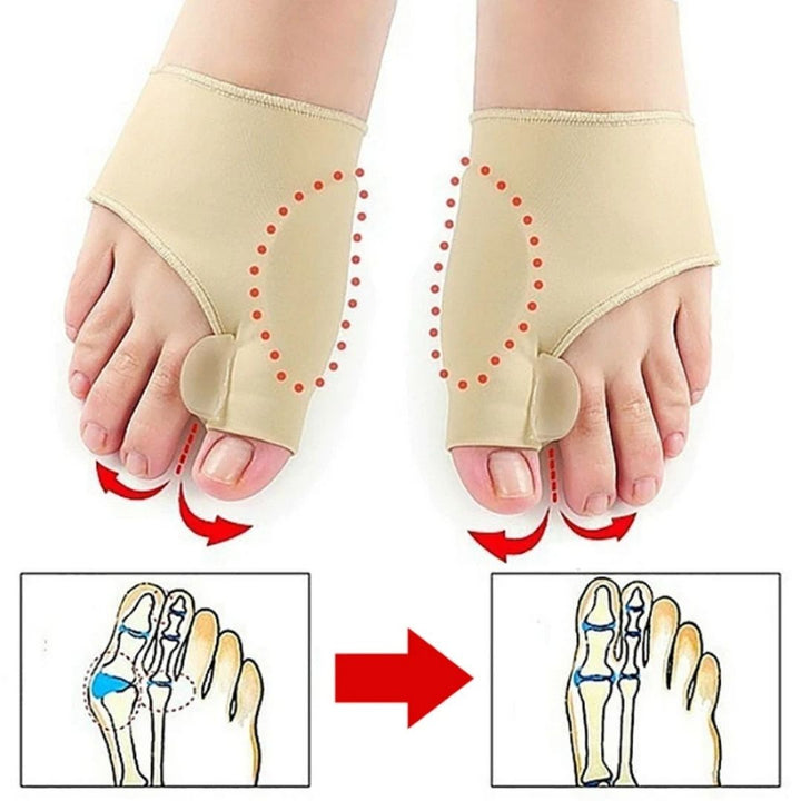 AlignWell Hallux Valgus Korrigerings Tå Separator | for Storetå Rejustering og Smertelindring – Ikke-Invasiv Løsning for Hallux Valgus Skanto