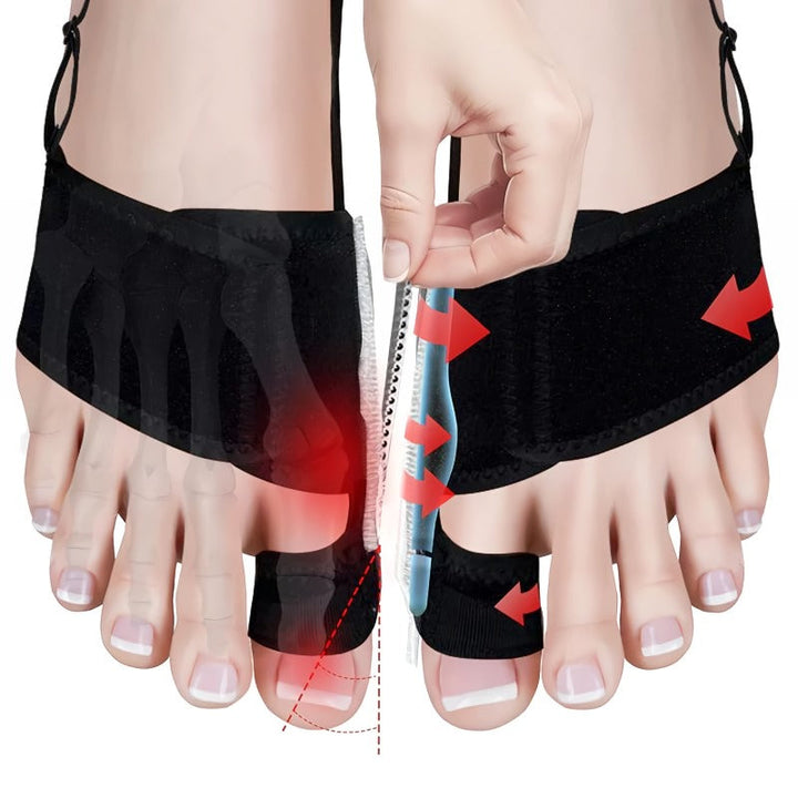 Skanto | Justerbar hallux valgus korrektor