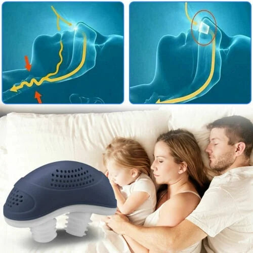 Skanto | Søvnløs, maskefri, Micro-CPAP Anti-Snorking