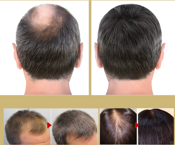 Norvo | VitaStrand – Opplev tykkere, sterkere og sunnere hår hver morgen