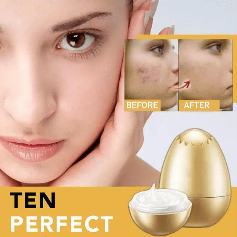 Skanto | Hefe Gold Egg Maske