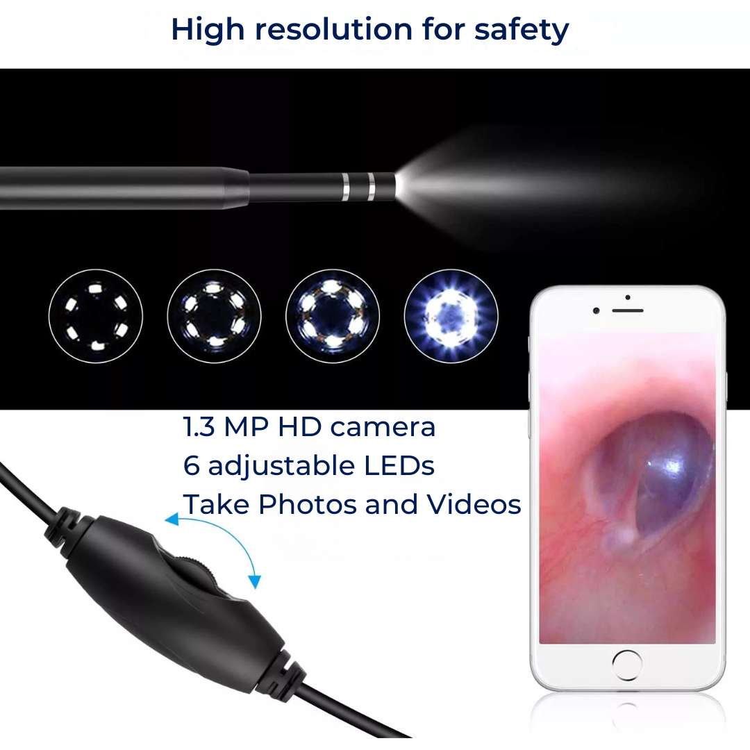 EarVision Profesjonell Øre Endoskop – HD Inspeksjon – Live Overvåking – Fang Bilder & Video – Fjerner Voks & Fremmedlegemer Skanto