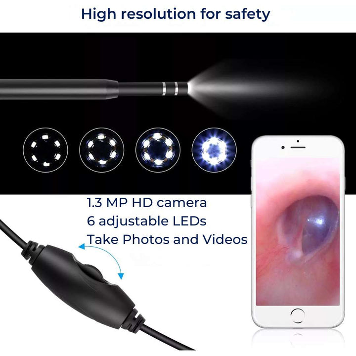 EarVision Profesjonell Øre Endoskop – HD Inspeksjon – Live Overvåking – Fang Bilder & Video – Fjerner Voks & Fremmedlegemer Skanto