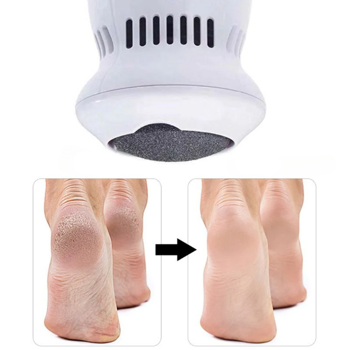 Skanto | Perfekt fotpleie uten anstrengelse