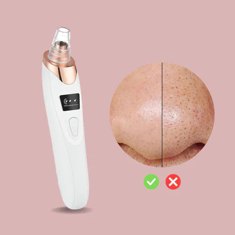 Skanto | Nano Elektrisk Vakuum Blackhead Fjerningsverktøy — Frigjør din strålende, klare hud uten smerte eller stress