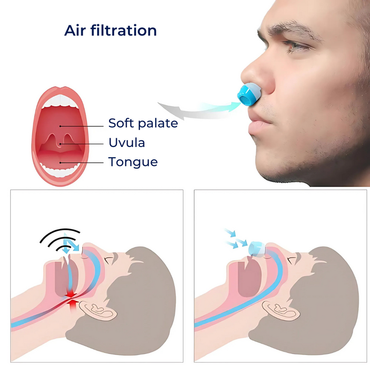SilentEase | Anti-Snorke Nese Dilatatorer – Snorke Lindring – Myk Silikon – Komfortabel Passform for Voksne Skanto