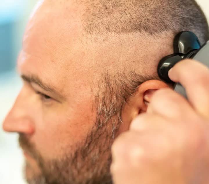 Skanto | 5-i-1 trimmer med flytende barberhoder og tilbehør