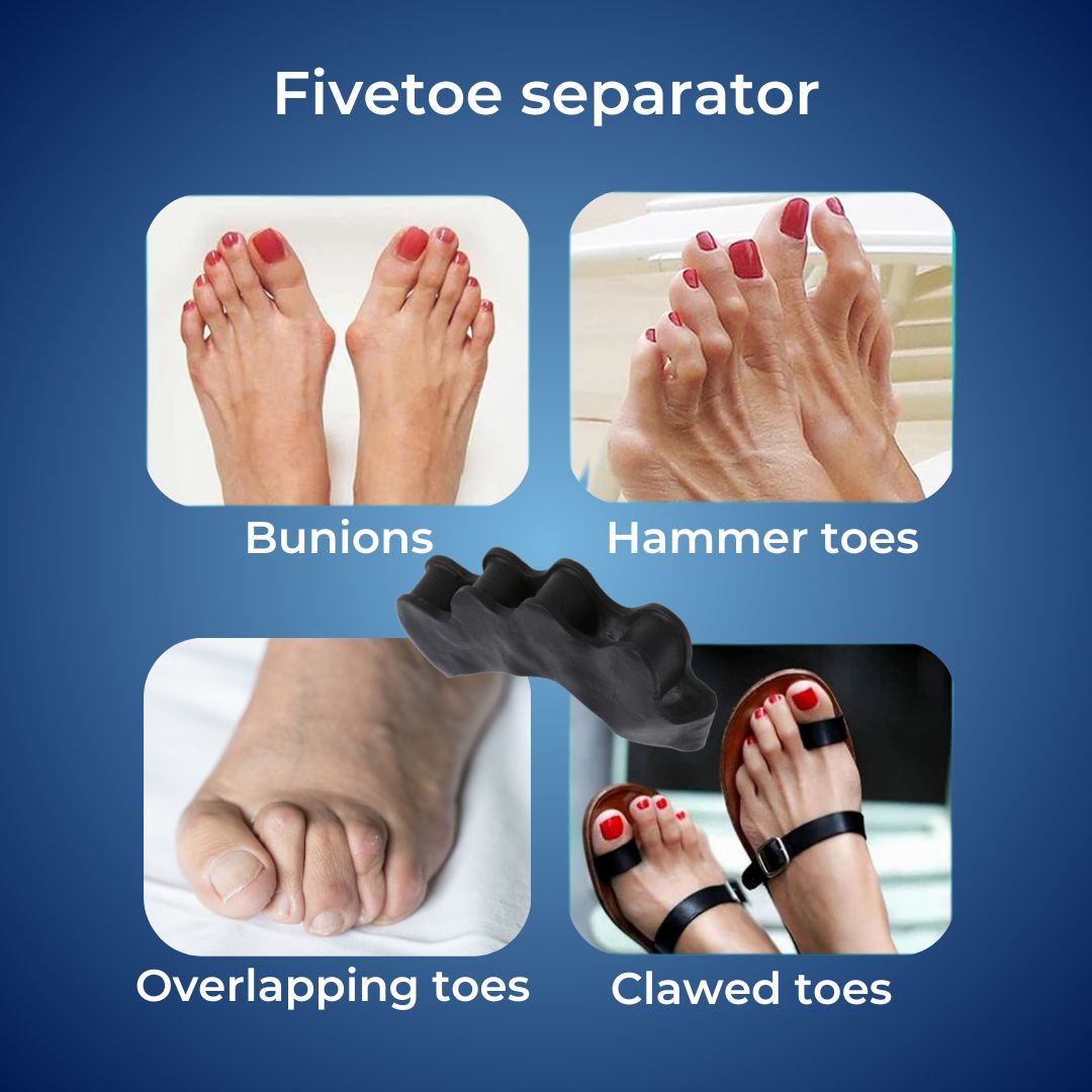 FlexAlign Tå Separator | Tå Justering og Smertelindring – Ideell for Hallux Valgus - Overlappende Tær - og Fot Komfort Skanto
