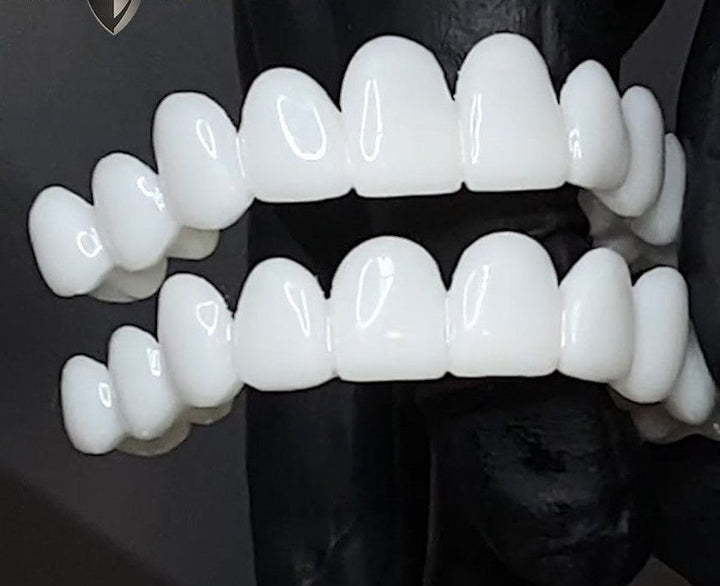 Kosmetiske Tann Toppers SmileShape – Gjenbrukbar, Fleksibel og Naturlig Hvit | Skanto