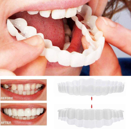 Skanto | Smile Veneer (Øvre & Nedre Inkludert)