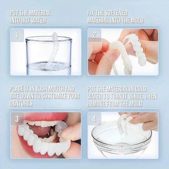 Skanto | Smile Veneer (Øvre & Nedre Inkludert)