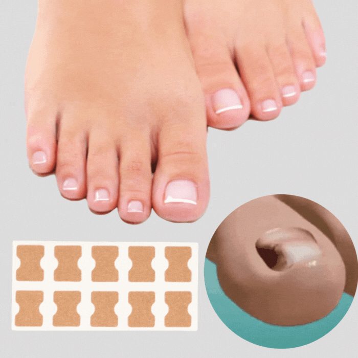 Skanto | ProFlexiPatches — Painless naturlige negler som du igjen viser stolt