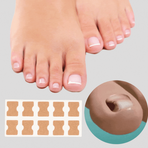 Skanto | ProFlexiPatches — Painless naturlige negler som du igjen viser stolt