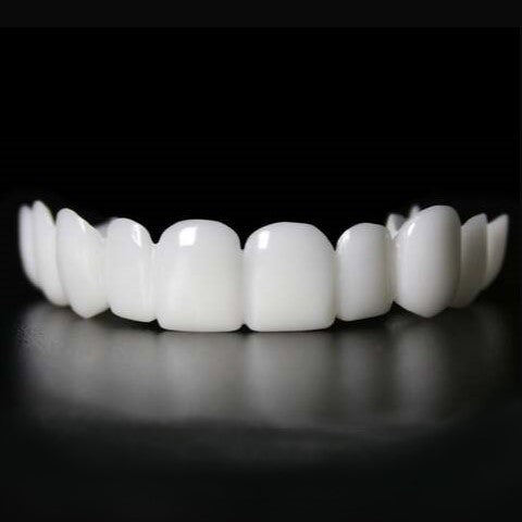 Sofortige Verschönerung Ihres Lächelns med Snap-on-Veneers