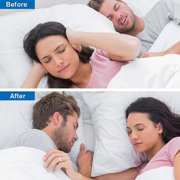 Skanto | Micro-CPAP Anti-Snorking Enhet
