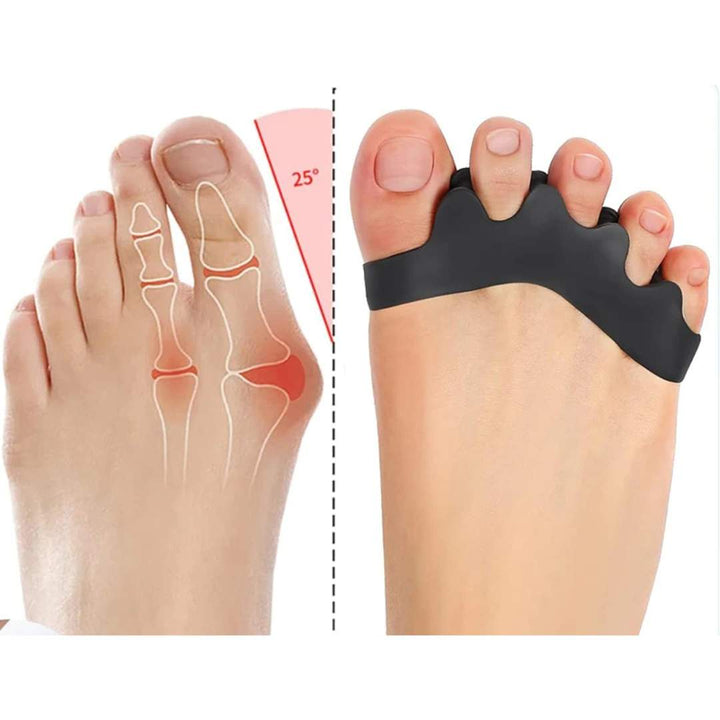 FlexAlign Tå Separator | Tå Justering og Smertelindring – Ideell for Hallux Valgus - Overlappende Tær - og Fot Komfort Skanto