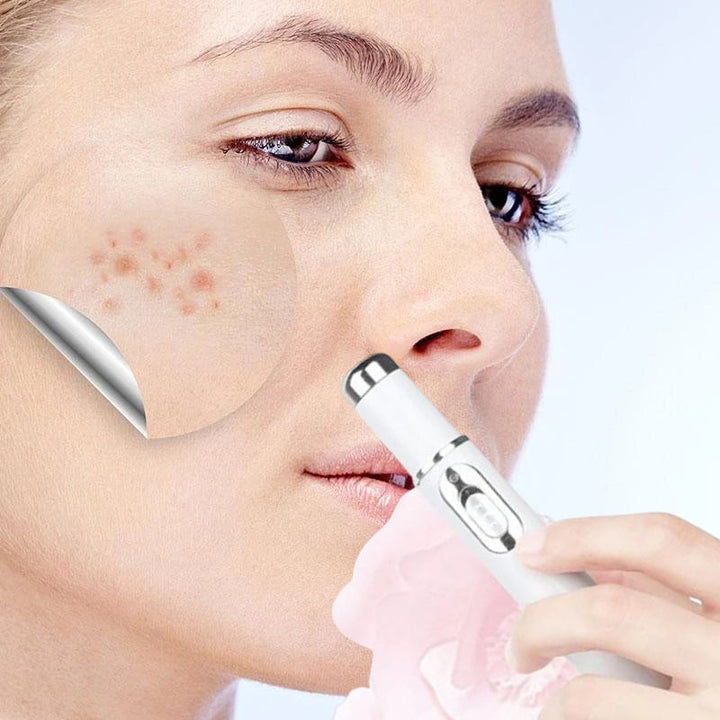 Skanto | ClearDerm - Rask, smertefri kvisefjerning for glatt, klar hud