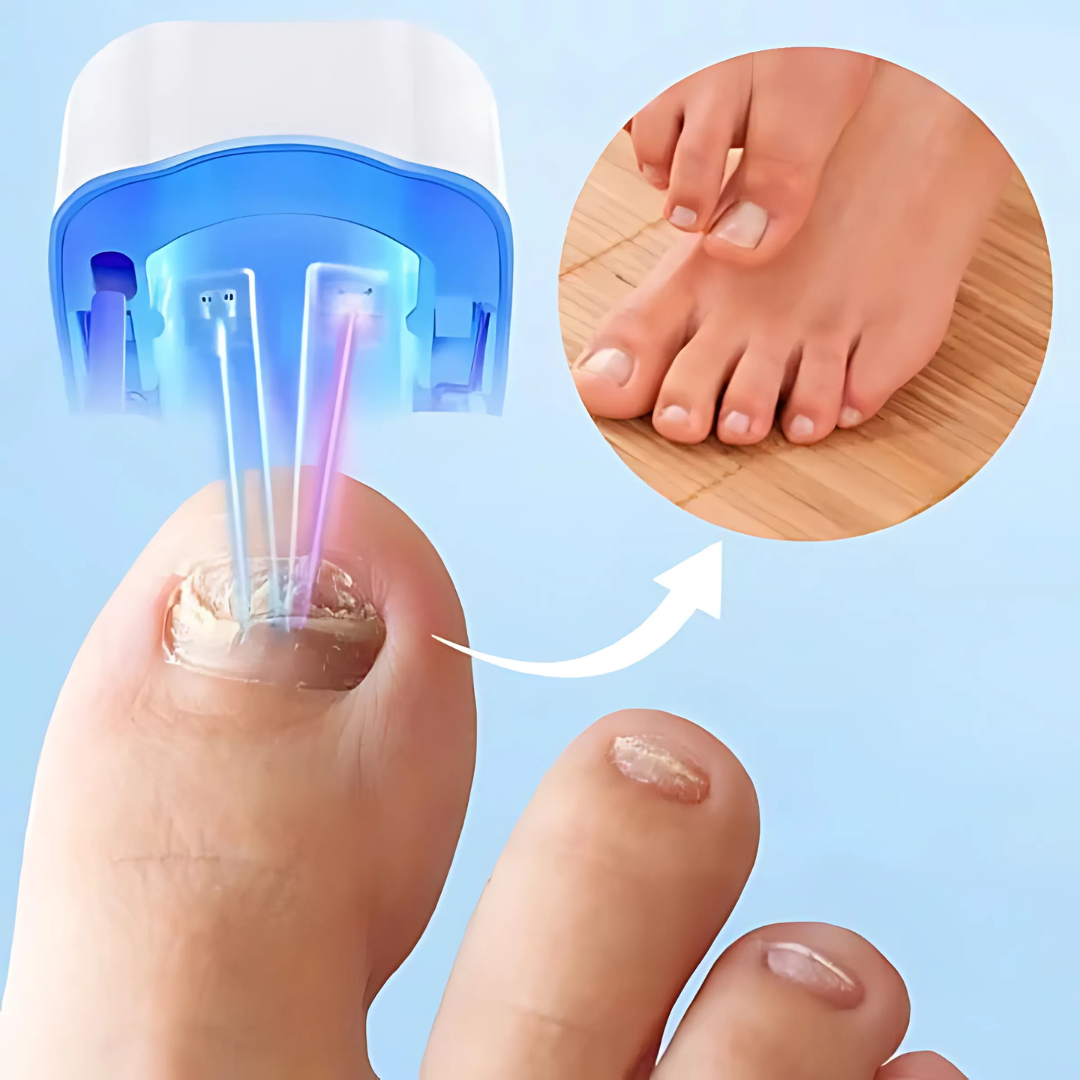 Skanto | Neglebehandling Laserapparat for Soppbehandling
