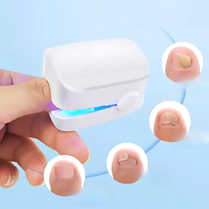 Skanto | Neglebehandling Laserapparat for Soppbehandling