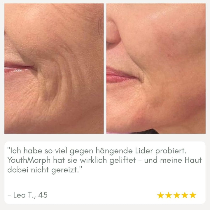 Skanto | YouthMorph — Tett hud på minutter for ditt ungdommelige WOW-øyeblikk
