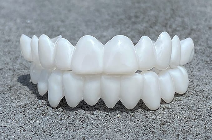 Kosmetische Zahnaufsätze von SmileShape – Wiederverwendbar, fleksibel og naturlig hvit