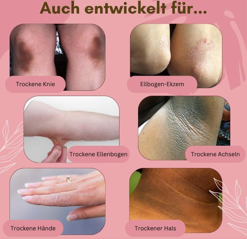 Skanto | Dermashield — Rask lindring for sprukne, kløende føtter som ønsker å puste fritt