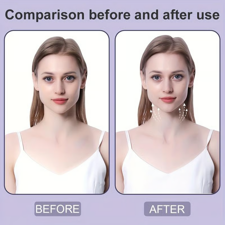 Skanto | VelvetLift — Skin umiddelbart ungdommelig og selvsikker med usynlig løft