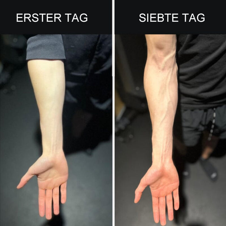 Skanto | Silikon Finger Treningstrener