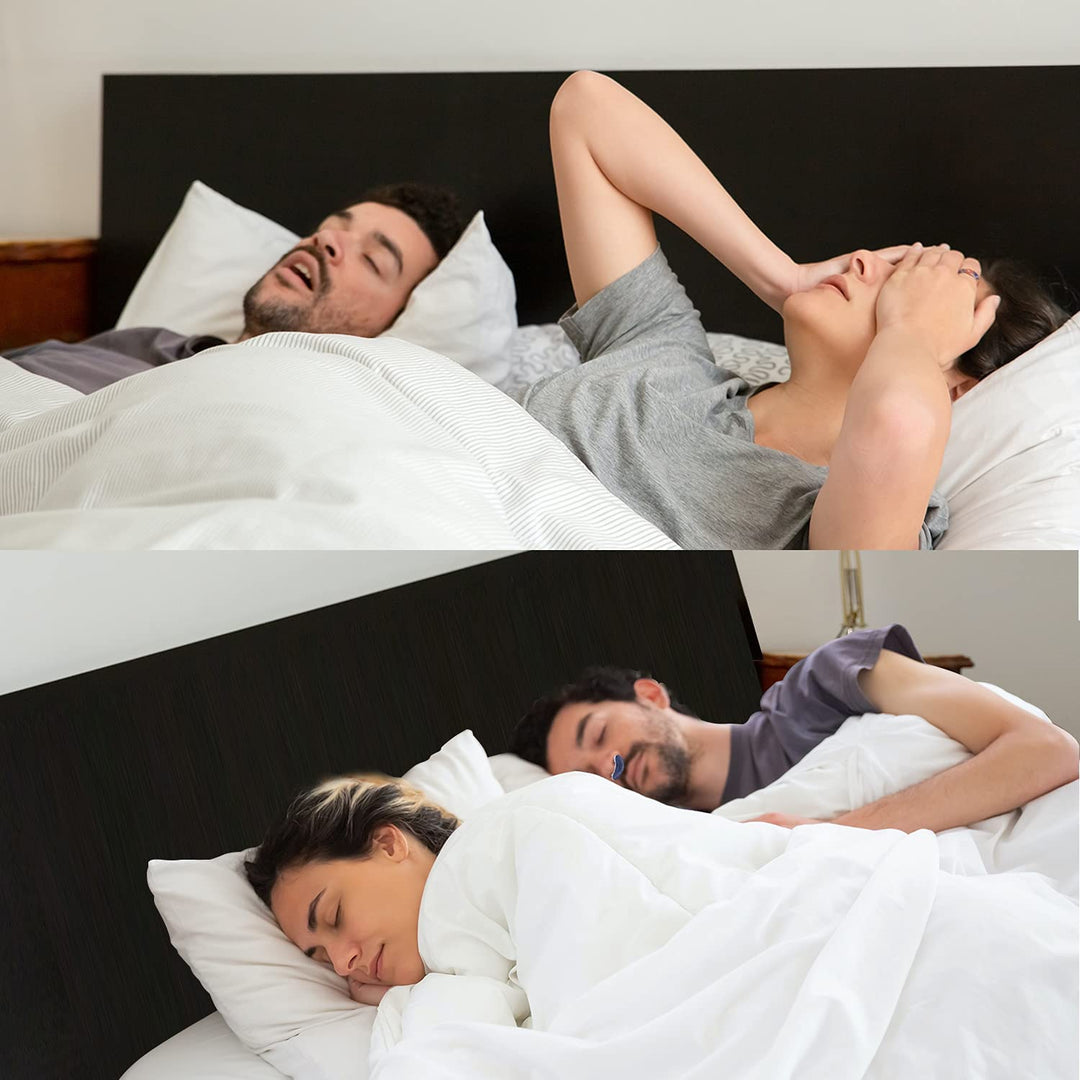Skanto | Antisnoringsenhet | Tubeless, maskefri mikro-CPAP